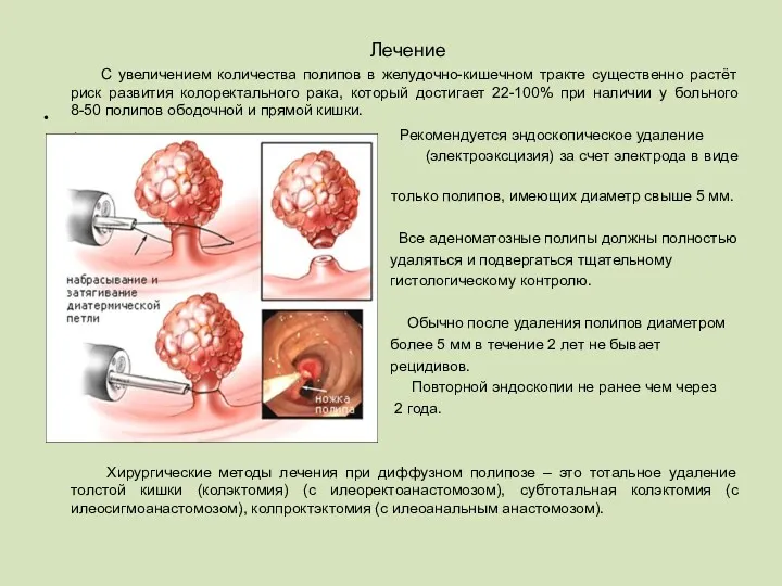 Лечение С увеличением количества полипов в желудочно-кишечном тракте существенно растёт
