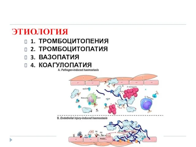 ЭТИОЛОГИЯ 1. ТРОМБОЦИТОПЕНИЯ 2. ТРОМБОЦИТОПАТИЯ 3. ВАЗОПАТИЯ 4. КОАГУЛОПАТИЯ