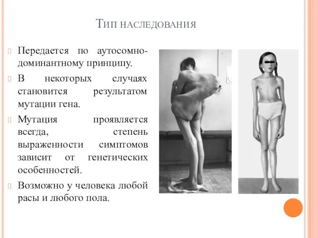 Тип наследования Передается по аутосомно-доминантному принципу. В некоторых случаях становится