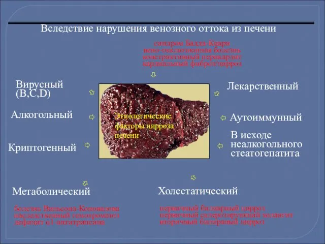 Метаболический болезнь Вильсона-Коновалова наследственный гемохроматоз дефицит α1-антитрипсина Алкогольный Лекарственный Вирусный