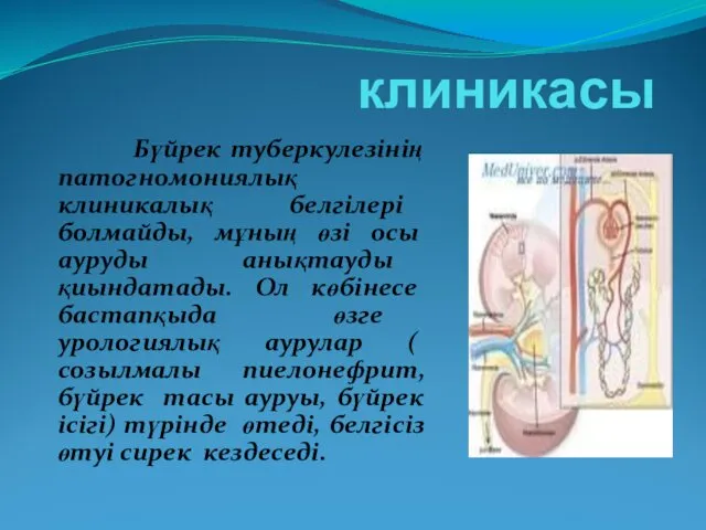 Бүйрек туберкулезінің патогномониялық клиникалық белгілері болмайды, мұның өзі осы ауруды