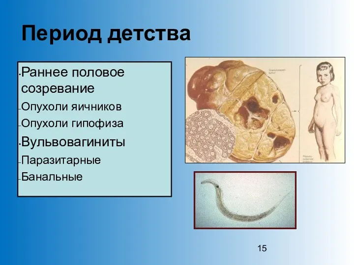 Период детства Раннее половое созревание Опухоли яичников Опухоли гипофиза Вульвовагиниты Паразитарные Банальные