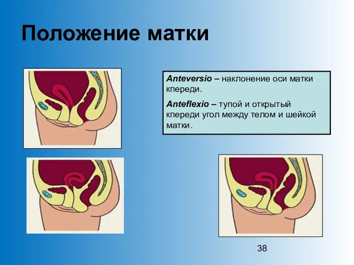 Положение матки Anteversio – наклонение оси матки кпереди. Аnteflexio –