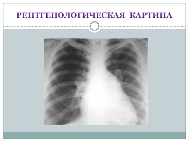 РЕНТГЕНОЛОГИЧЕСКАЯ КАРТИНА