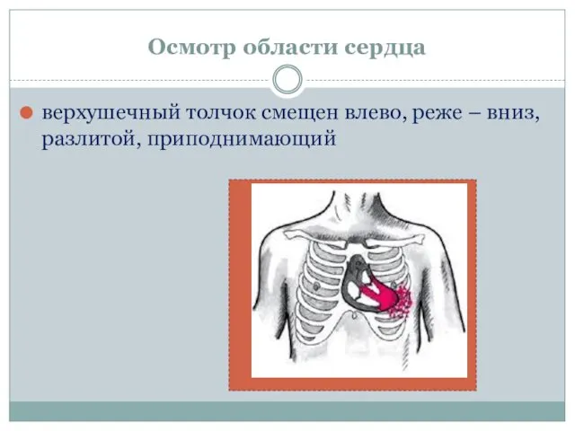 Осмотр области сердца верхушечный толчок смещен влево, реже – вниз, разлитой, приподнимающий