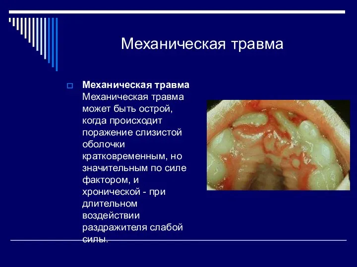 Механическая травма Механическая травма Механическая травма может быть острой, когда происходит поражение слизистой