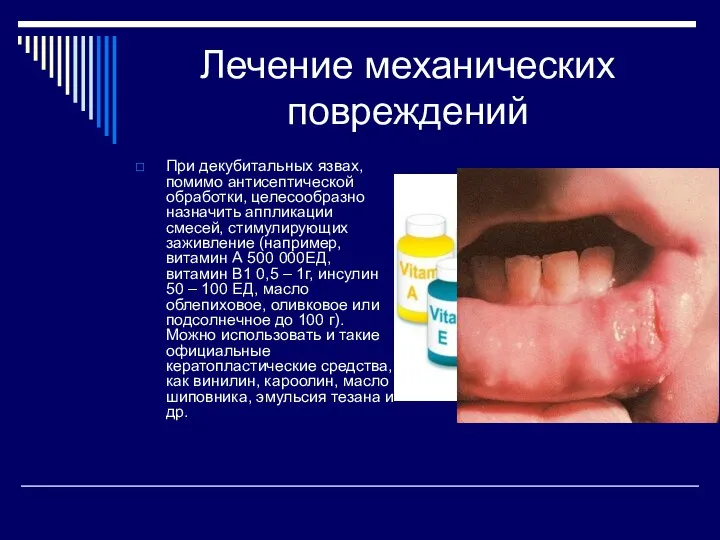 Лечение механических повреждений При декубитальных язвах, помимо антисептической обработки, целесообразно назначить аппликации смесей,