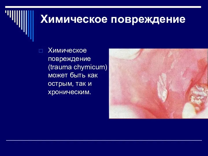 Химическое повреждение Химическое повреждение (trauma chymicum) может быть как острым, так и хроническим.