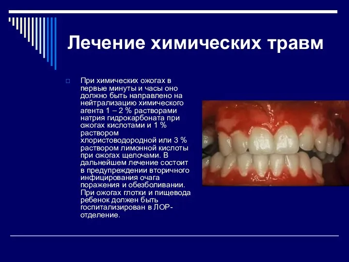 Лечение химических травм При химических ожогах в первые минуты и часы оно должно