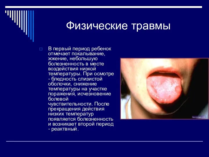 Физические травмы В первый период ребенок отмечает покалывание, жжение, небольшую болезненность в месте