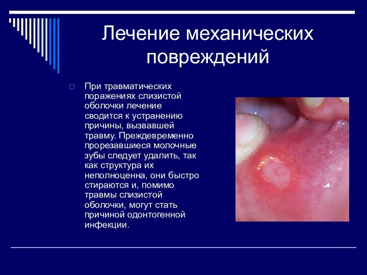 Лечение механических повреждений При травматических поражениях слизистой оболочки лечение сводится к устранению причины,