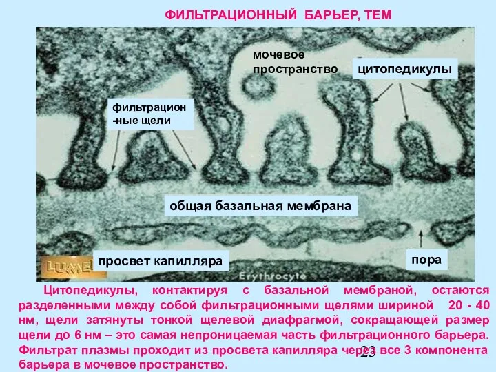 Цитопедикулы, контактируя с базальной мембраной, остаются разделенными между собой фильтрационными