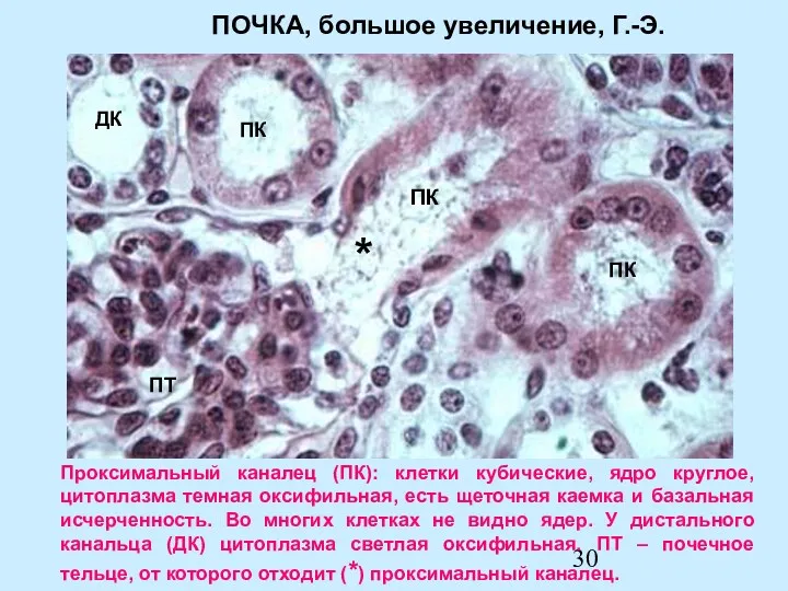 Проксимальный каналец (ПК): клетки кубические, ядро круглое, цитоплазма темная оксифильная,