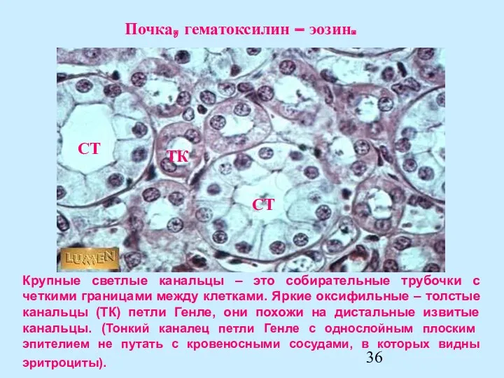 Крупные светлые канальцы – это собирательные трубочки с четкими границами