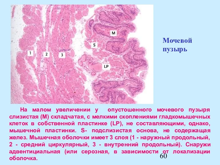 На малом увеличении у опустошенного мочевого пузыря слизистая (М) складчатая,