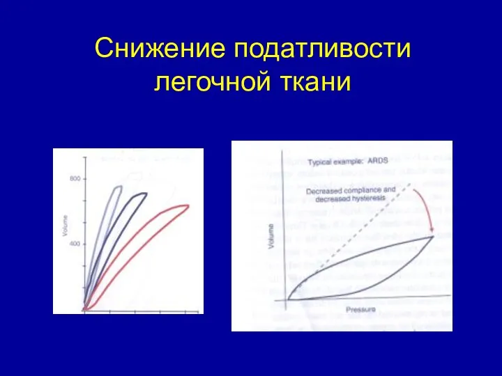 Снижение податливости легочной ткани