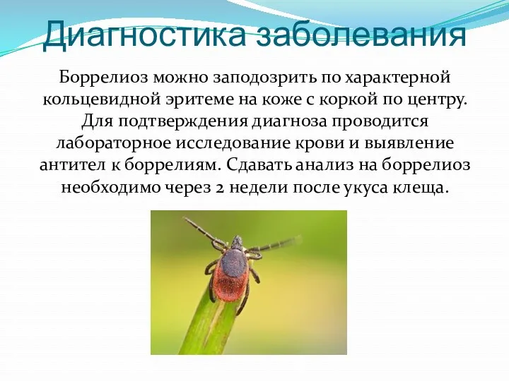 Диагностика заболевания Боррелиоз можно заподозрить по характерной кольцевидной эритеме на