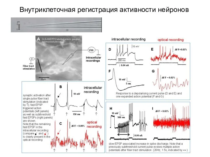 Внутриклеточная регистрация активности нейронов