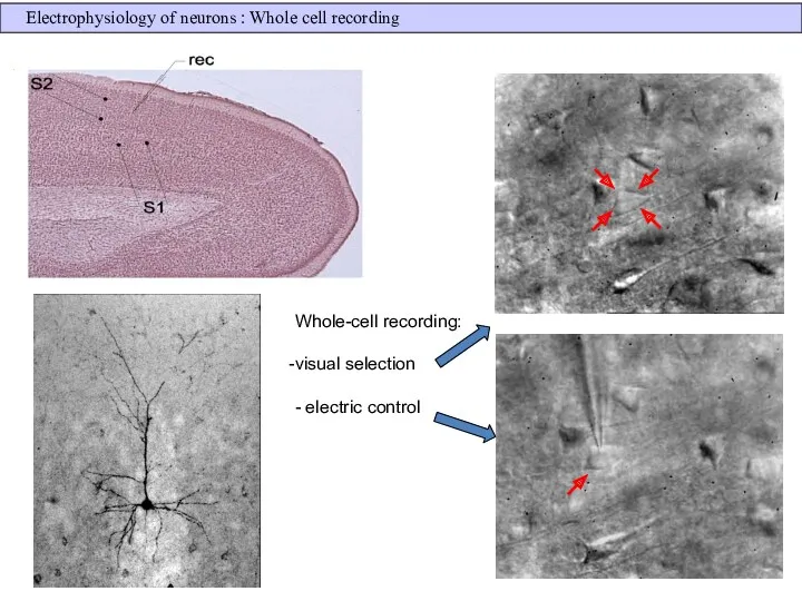 Whole-cell recording: visual selection - electric control