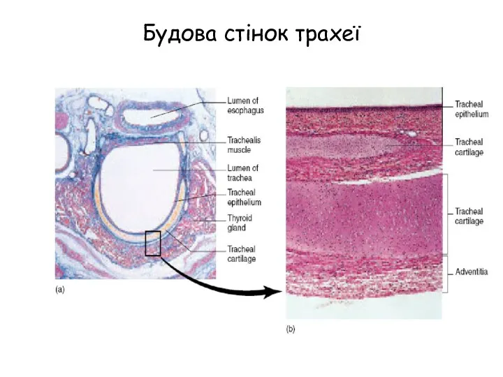 Будова стінок трахеї