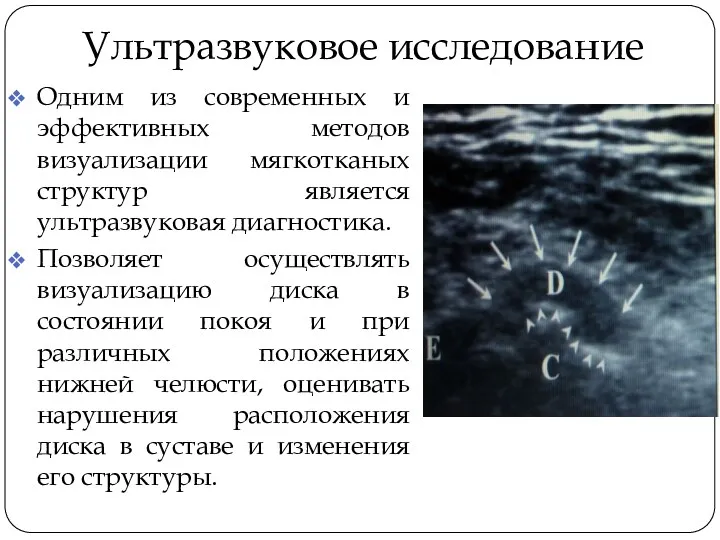 Ультразвуковое исследование Одним из современных и эффективных методов визуализации мягкотканых