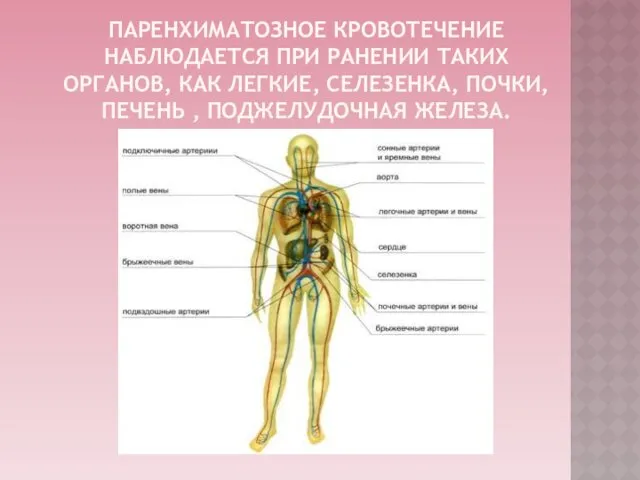 ПАРЕНХИМАТОЗНОЕ КРОВОТЕЧЕНИЕ НАБЛЮДАЕТСЯ ПРИ РАНЕНИИ ТАКИХ ОРГАНОВ, КАК ЛЕГКИЕ, СЕЛЕЗЕНКА, ПОЧКИ, ПЕЧЕНЬ , ПОДЖЕЛУДОЧНАЯ ЖЕЛЕЗА.