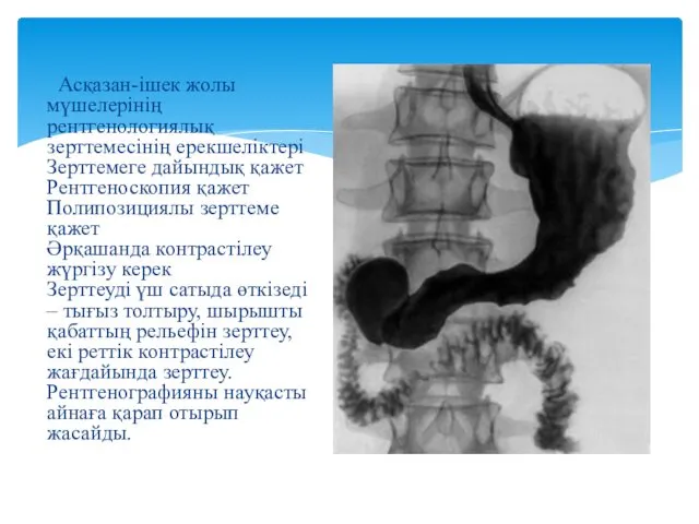 Асқазан-ішек жолы мүшелерінің рентгенологиялық зерттемесінің ерекшеліктері Зерттемеге дайындық қажет Рентгеноскопия