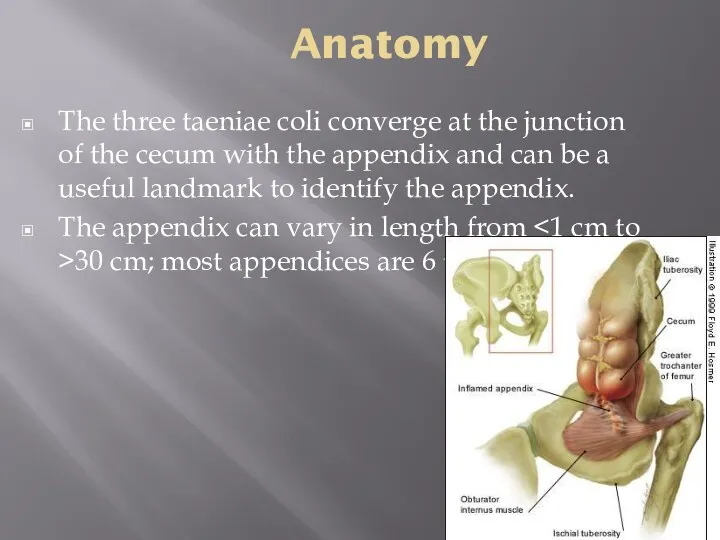 Anatomy The three taeniae coli converge at the junction of