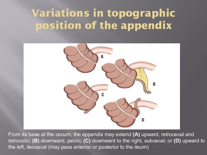 Variations in topographic position of the appendix From its base