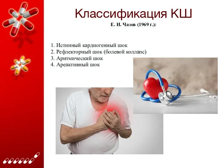 Классификация КШ 1. Истинный кардиогенный шок 2. Рефлекторный шок (болевой