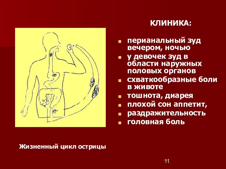 Жизненный цикл острицы КЛИНИКА: перианальный зуд вечером, ночью у девочек