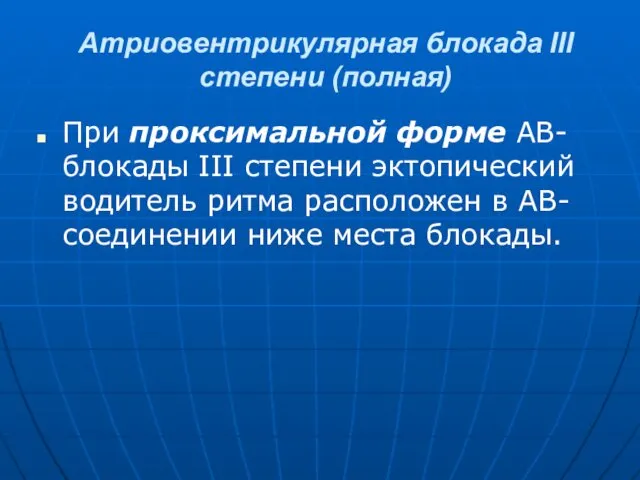 Атриовентрикулярная блокада III степени (полная) При проксимальной форме АВ-блокады III