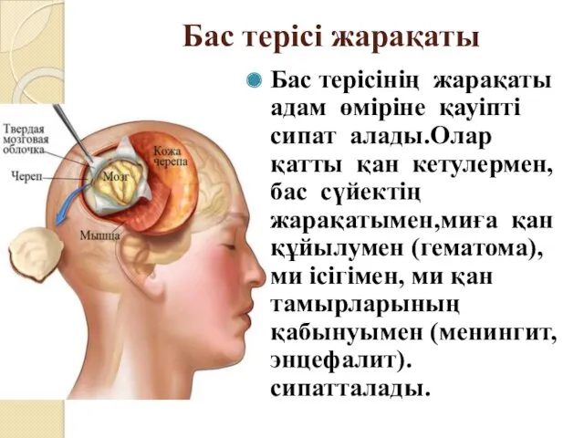 Бас терісі жарақаты Бас терісінің жарақаты адам өміріне қауіпті сипат алады.Олар қатты қан