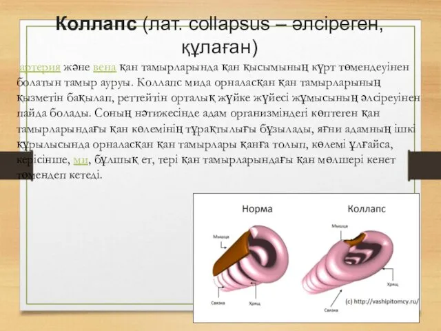 Коллапс (лат. collapsus – әлсіреген, құлаған) артерия және вена қан