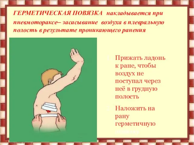 ГЕРМЕТИЧЕСКАЯ ПОВЯЗКА накладывается при пневмотораксе– засасывание воздуха в плевральную полость