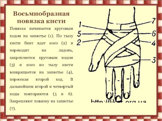 Восьмиобразная повязка кисти Повязка начинается круговым ходом на запястье (1).