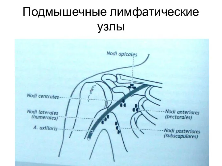 Подмышечные лимфатические узлы