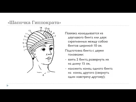 «Шапочка Гиппократа» Повязка накладывается из двуглавого бинта или двух скрепленных между собою бинтов