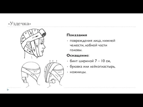 «Уздечка» Показания повреждения лица, нижней челюсти, лобной части головы. Оснащение: бинт шириной 7