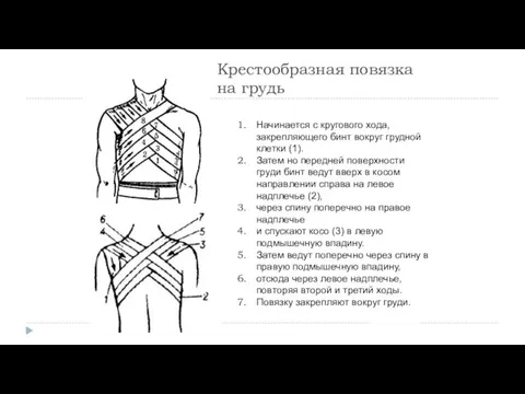 Крестообразная повязка на грудь Начинается с кругового хода, закрепляющего бинт вокруг грудной клетки