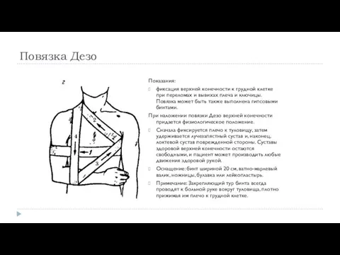 Повязка Дезо Показания: фиксация верхней конечности к грудной клетке при переломах и вывихах