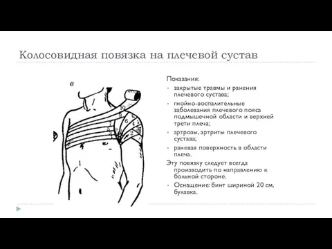 Колосовидная повязка на плечевой сустав Показания: закрытые травмы и ранения плечевого сустава; гнойно-воспалительные