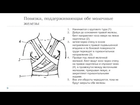 Повязка, поддерживающая обе молочные железы Начинается с кругового тура (1). Дойдя до основания