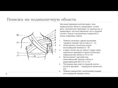 Повязка на подмышечную область Наложив перевязочный материал, всю подмышечную область прикрывают слоем ваты,