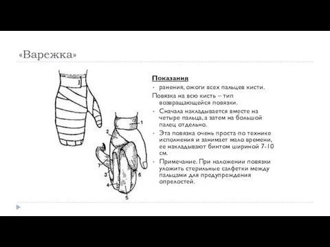 «Варежка» Показания ранения, ожоги всех пальцев кисти. Повязка на всю кисть – тип