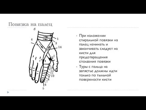 Повязка на палец При наложении спиральной повязки на палец начинать и заканчивать следует