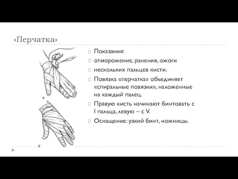 «Перчатка» Показания: отморожение, ранения, ожоги нескольких пальцев кисти. Повязка «перчатка» объединяет «спиральные повязки»,