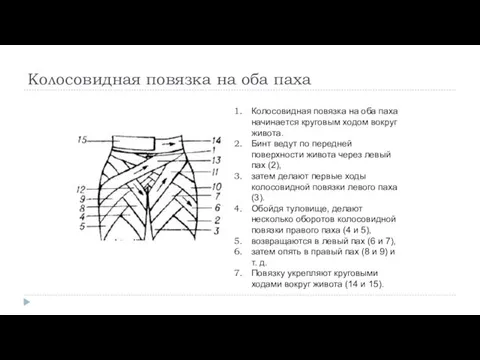 Колосовидная повязка на оба паха Колосовидная повязка на оба паха начинается круговым ходом