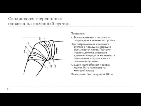 Сходящаяся «черепашья» повязка на коленный сустав Показания: Воспалительные процессы и повреждения коленного сустава