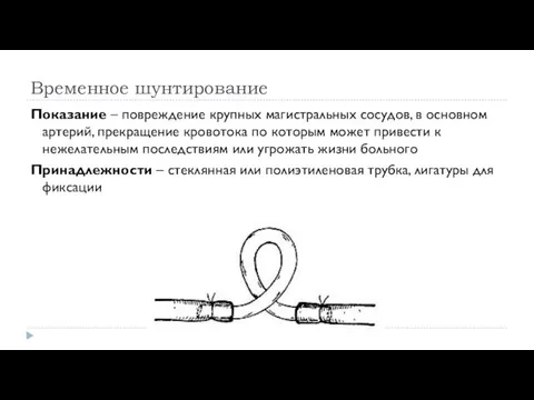 Временное шунтирование Показание – повреждение крупных магистральных сосудов, в основном артерий, прекращение кровотока